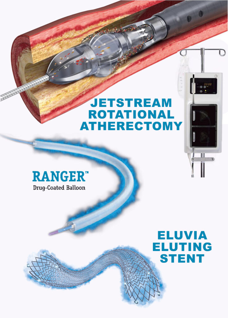 Arterial Technologies – Vascular ART